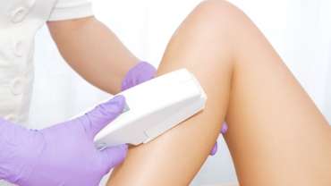 Laser Hair Removal